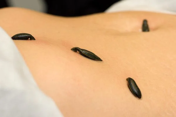 Bizarre Beauty Treatments