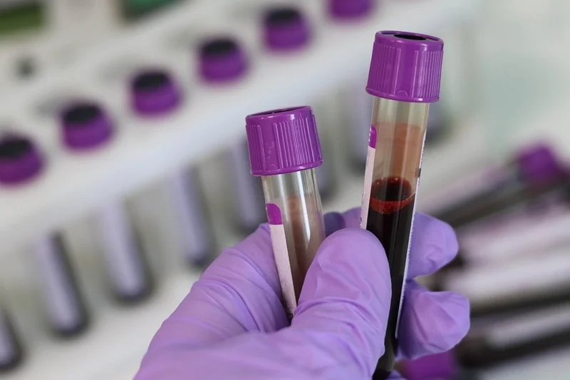 Plasma Bank, CM Kejriwal